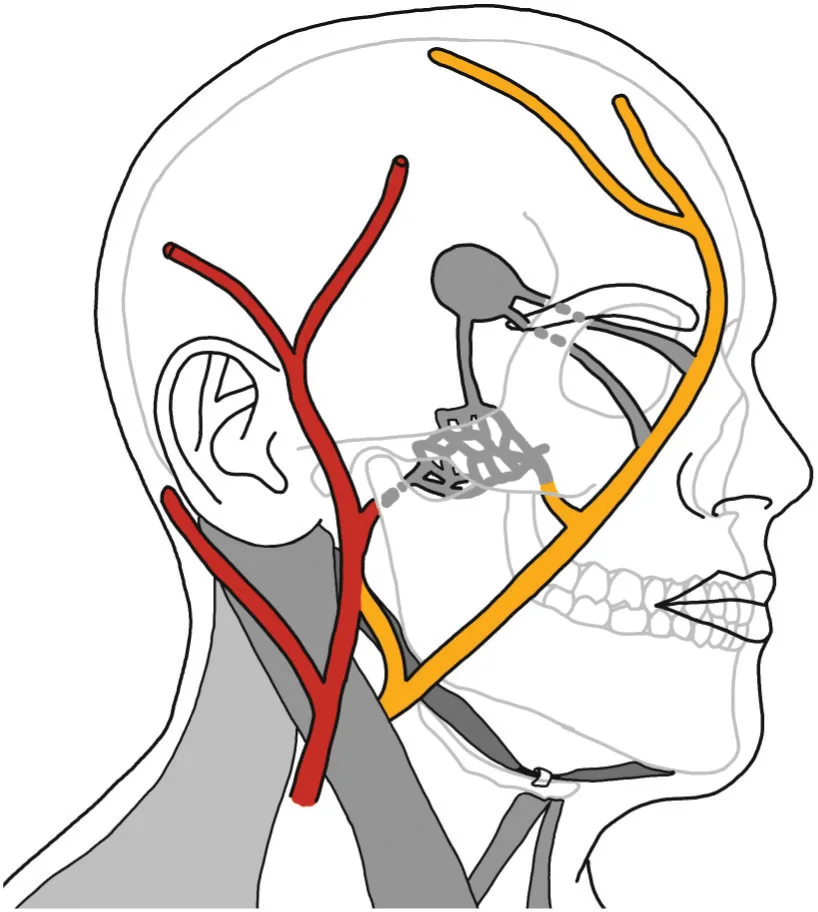 Fig 11. Facial venous drainage territory and its relation to the retromandibular